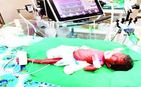 750 ग्राम का नवजात, 53 दिन की जंग, रीवा एसएनसीयू ने रचा जीवन का चमत्कार