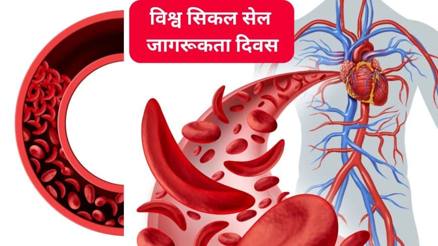 रक्त की बूँद में छिपा संघर्ष: विश्व सिकल सेल जागरूकता दिवस