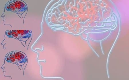 विश्व मस्तिष्क दिवस: हमारे सबसे महत्वपूर्ण अंग का स्वास्थ्य