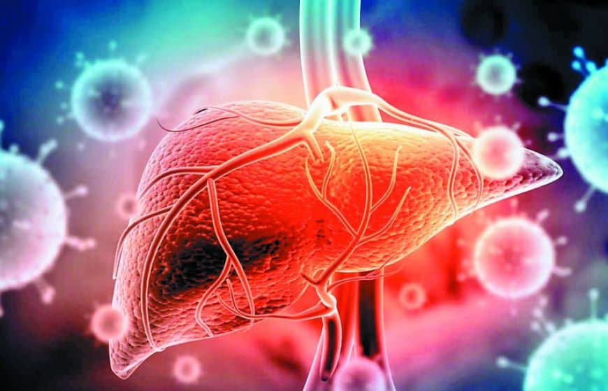 सतना में एक साल में सामने आए 88 हेपेटाइटिस मरीज, 26 नवजात भी संक्रमित — विषाक्त पानी और भोजन बना सबसे बड़ा कारण