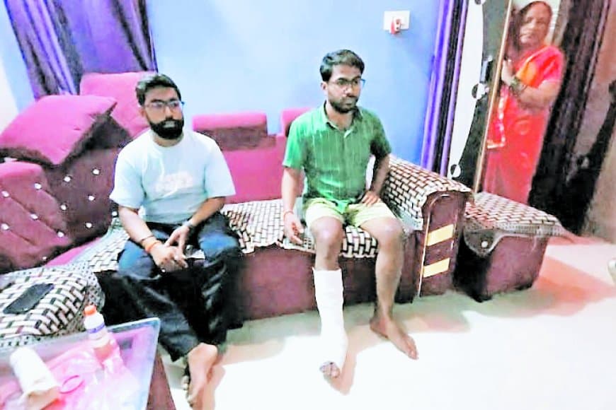 रीवा में व्यापारी भाइयों से बाइकर्स गैंग ने दिनदहाड़े की 50 हजार की लूट, एक का टूटा पैर - CCTV में दिखे आरोपी, पुलिस अब भी खाली हाथ