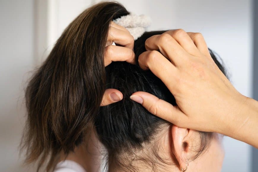 स्कैल्प की सूजन और खुजली से छुटकारा पाने आजमाएं ये उपाय, डैंड्रफ से भी मिलेगी राहत
