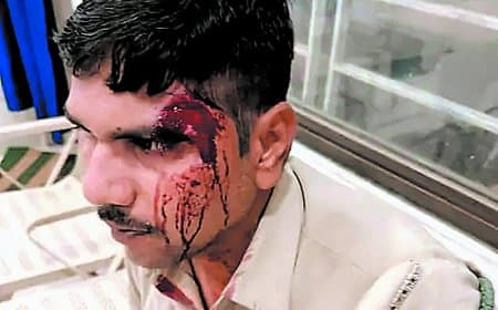 सागौन तस्करों ने वनकर्मी पर किया हमला, गंभीर घायल