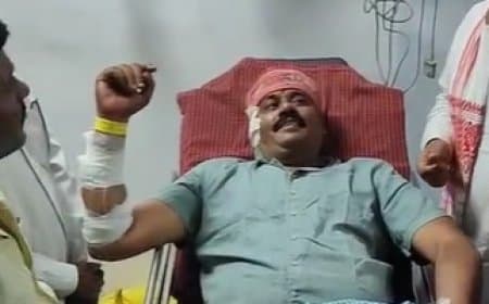 पन्ना: नगर परिषद अध्यक्ष पति पर जानलेवा हमला, गोली मारकर हमलावर फरार; सतना रेफर, भोपाल एयरलिफ्ट