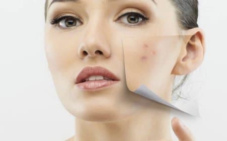 चेहरे पर दाग-धब्बों से छुटकारा पाने के लिए लगाएं इन 2 चीजों को मिक्स  