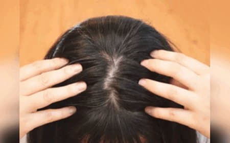 सफेद बालों को काला करने के सबसे असरदार तरीके, एक-एक  हो जाएगा काला 