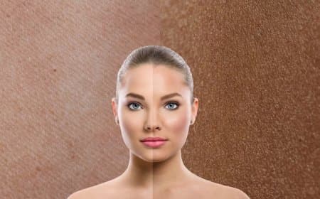 इस विटामिन की कमी से काला पड़ने लगता है चेहरा? खाने में शामिल करें ये चीज 