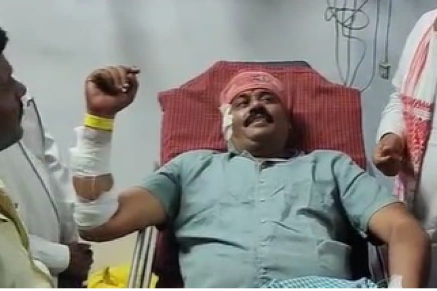 पन्ना: नगर परिषद अध्यक्ष पति पर जानलेवा हमला, गोली मारकर हमलावर फरार; सतना रेफर, भोपाल एयरलिफ्ट