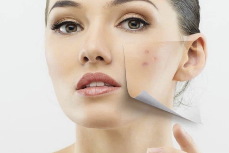 चेहरे पर दाग-धब्बों से छुटकारा पाने के लिए लगाएं इन 2 चीजों को मिक्स  
