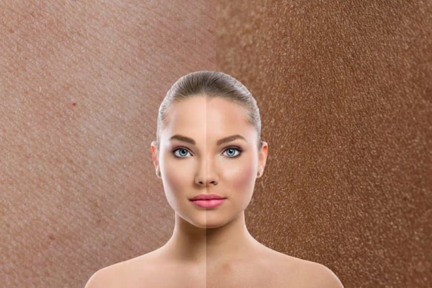 इस विटामिन की कमी से काला पड़ने लगता है चेहरा? खाने में शामिल करें ये चीज 