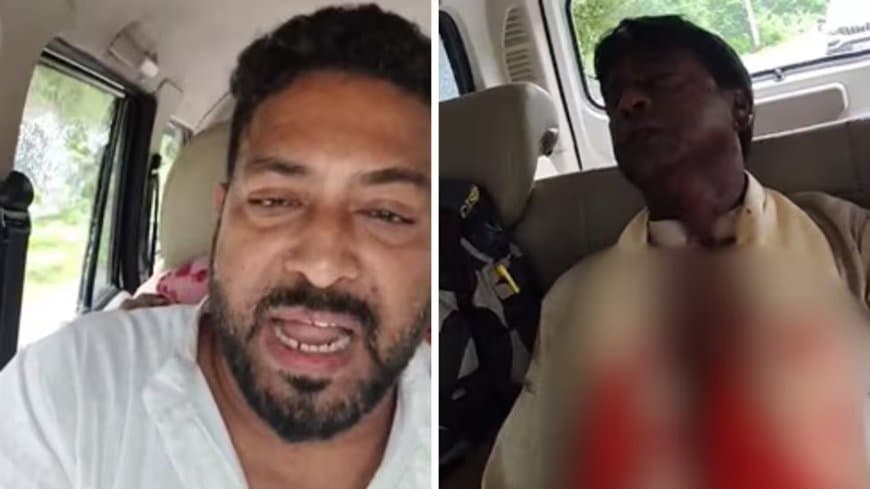 बंगाल में भाजपा सांसद-विधायक का फोड़ा सिर... गाड़ियों पर किया पथराव