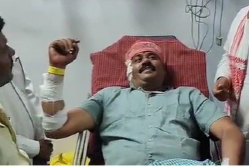 पन्ना: नगर परिषद अध्यक्ष पति पर जानलेवा हमला, गोली मारकर हमलावर फरार; सतना रेफर, भोपाल एयरलिफ्ट