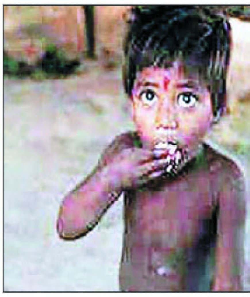 सतना में कुपोषण का कलंक कायम: नागौद के पनास आंगनवाड़ी में 7 बच्चे अति गंभीर कुपोषित, योजनाओं के बावजूद मासूमों की जिंदगी अधर में