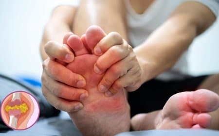 सर्दियों में अचानक तेजी से बढ़ने लगता है यूरिक एसिड? इन उपायों से कर सकते हैं बचाव 