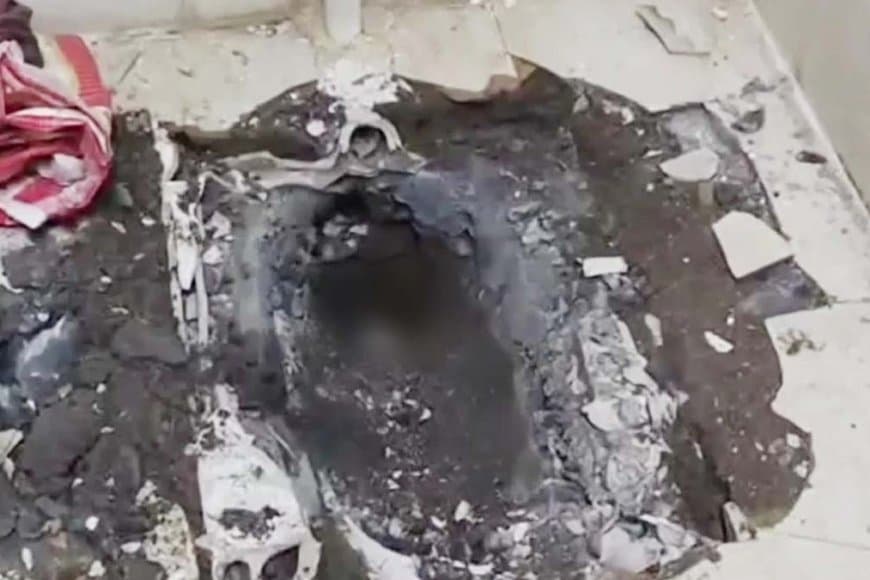 छिंदवाड़ा: परासिया सिविल अस्पताल के टॉयलेट कमोड में मिला नवजात का शव, 8 घंटे बाद निकाला गया