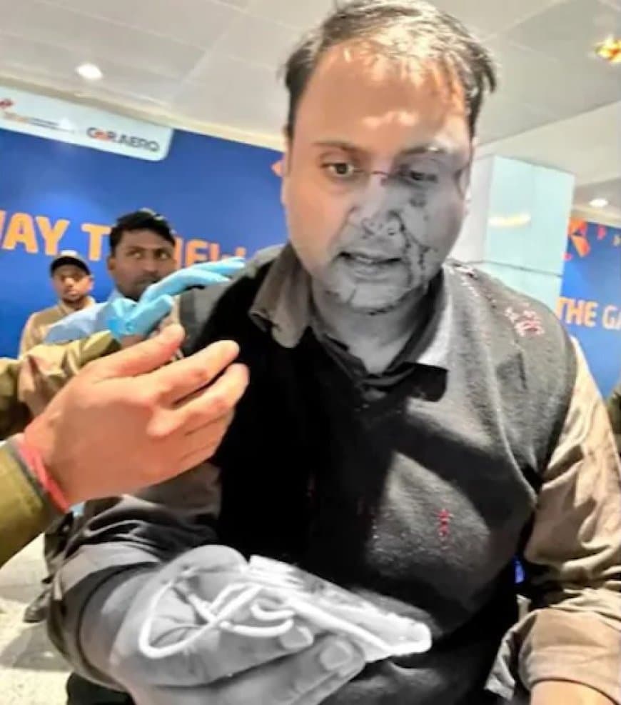 दिल्ली एयरपोर्ट... पायलट ने यात्री को बेरहमी से पीटा... सस्पेंड