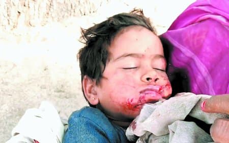 आंगन में खेल रही बच्ची पर आवारा कुत्ते का जानलेवा हमला मचा हड़कंप