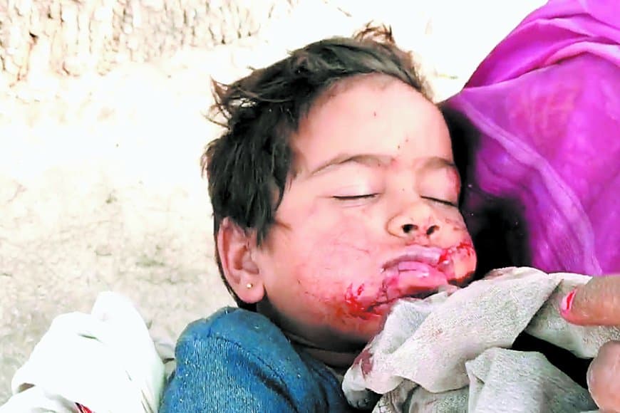 आंगन में खेल रही बच्ची पर आवारा कुत्ते का जानलेवा हमला मचा हड़कंप