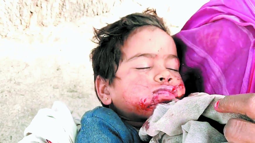 आंगन में खेल रही बच्ची पर आवारा कुत्ते का जानलेवा हमला मचा हड़कंप