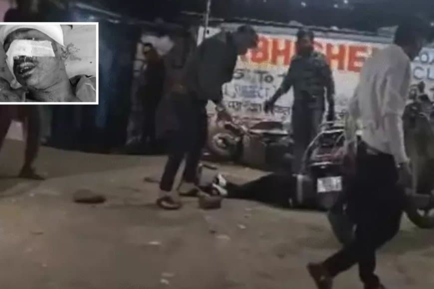 भोपाल के भीम नगर में अक्कू गैंग का जानलेवा हमला: पुरानी रंजिश में युवक को चाकुओं से गोदा