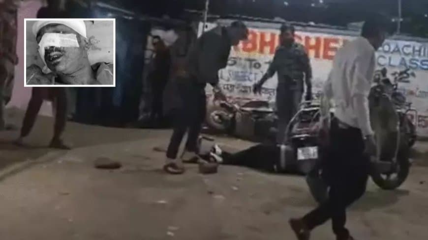 भोपाल के भीम नगर में अक्कू गैंग का जानलेवा हमला: पुरानी रंजिश में युवक को चाकुओं से गोदा