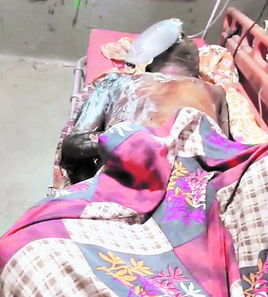 एसी विहीन एंबुलेंस में झुलसे मरीज, आपातकालीन सेवाओं पर गंभीर सवाल