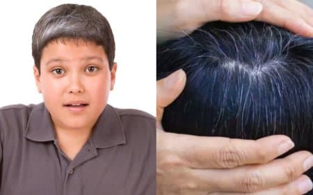 कम उम्र हो रहे सफेद बालों के पीछे कहीं ये वजहें तो नहीं, अगर ऐसा है तो तुरंत संभल जाएं !