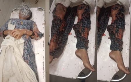 ग्वालियर... निकाह से इंकार पर भड़के जेठ ने भाई की पत्नी पर फेंका तेजाब