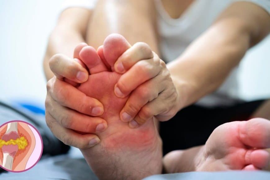 सर्दियों में अचानक तेजी से बढ़ने लगता है यूरिक एसिड? इन उपायों से कर सकते हैं बचाव