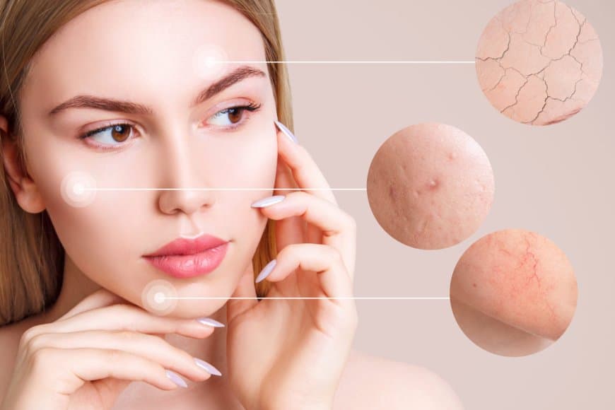 घर की रसोई में छिपा है ख़ूबसूरती का खजाना, जो झुर्रियों से लेकर त्वचा के रूखेपन को कर देगा गायब