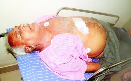 एंडोस्कोपी के दौरान लापरवाही से बुजुर्ग की मौत, निजी अस्पताल में परिजनों का हंगामा