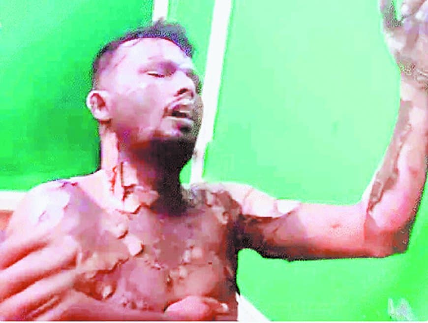 मऊगंज में चार युवकों पर पेट्रोल डालकर जिंदा जलाने का प्रयास, एक की हालत गंभीर, प्रधान आरक्षक निलंबित मऊगंज में चार युवकों पर पेट्रोल डालकर जिंदा जलाने का प्रयास, एक की हालत गंभीर, प्रधान आरक्षक निलंबित